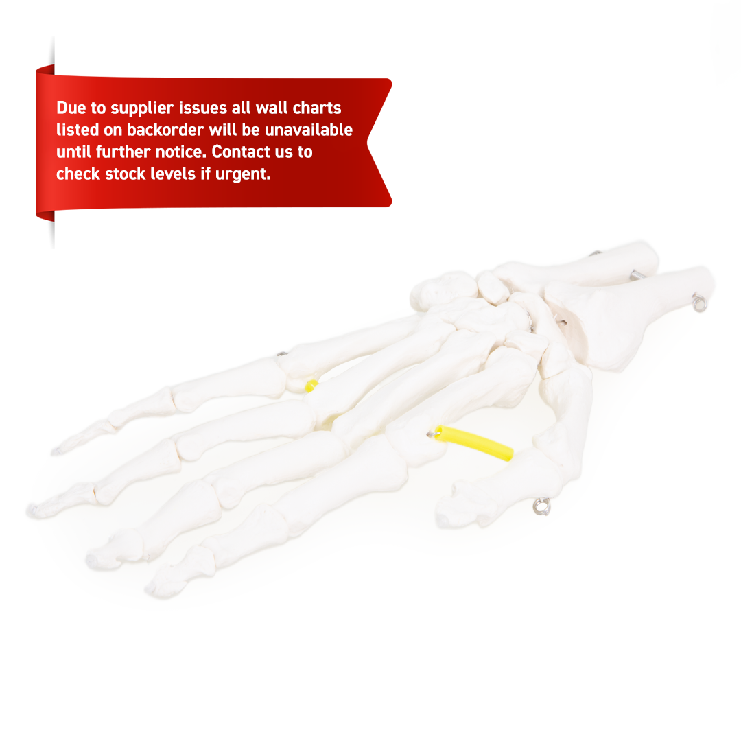 Anatomical model of a hand with a red banner indicating stock availability issues.