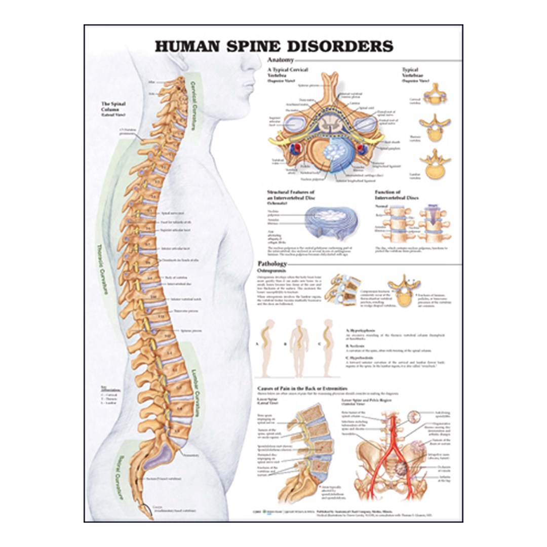 Human Spine Disorders Anatomical Chart